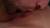 son bouton frétille,